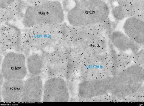 抗體費(免疫電鏡)