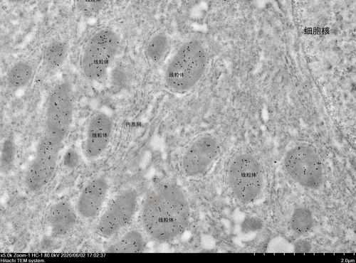 超薄切片(鎳網(wǎng))