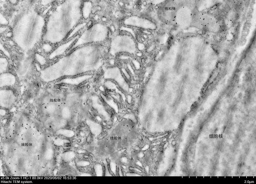超薄切片(鎳網(wǎng))