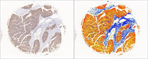 IHC芯片AI分析（面積）