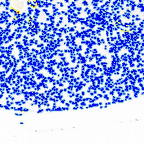 IHC切片AI分析（面積）