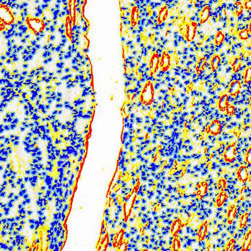 IHC切片AI分析（面積）