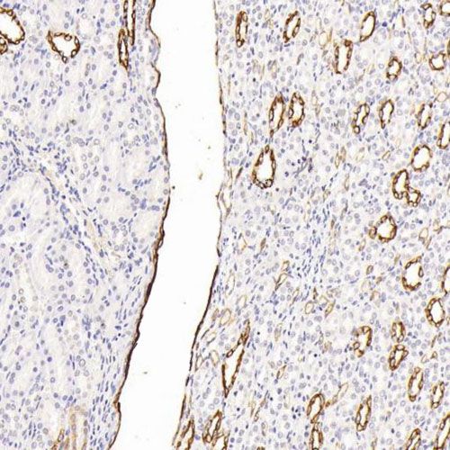 IHC切片AI分析（面積）