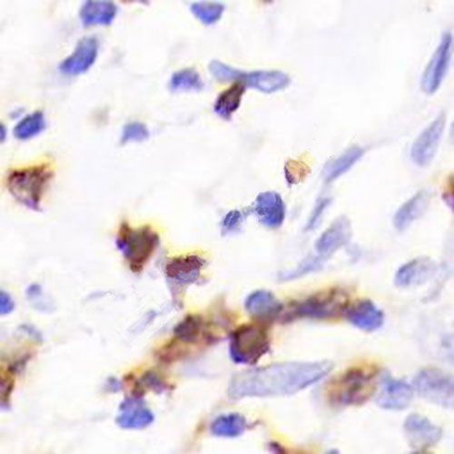 IHC芯片AI分析（個數）