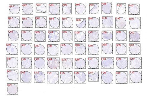 IHC芯片AI分析（個數）