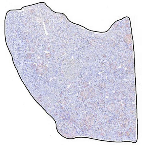 IHC切片AI分析（個數）