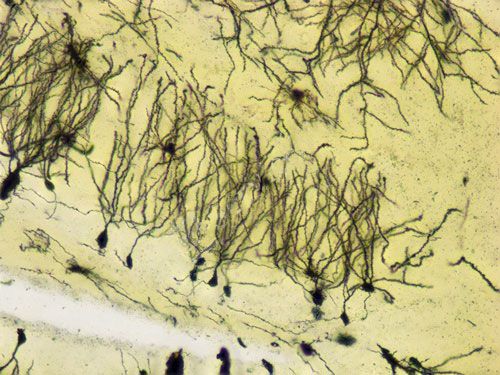 拍照（景深擴展）