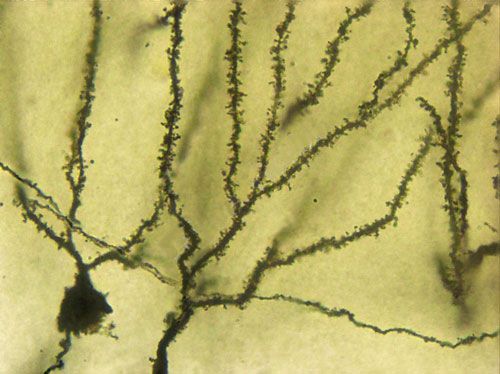 拍照（景深擴展）