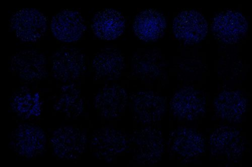 TUNEL（細(xì)胞芯片）檢測(cè)