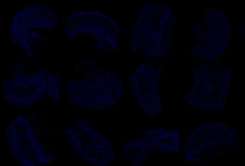 TUNEL（組織芯片）檢測