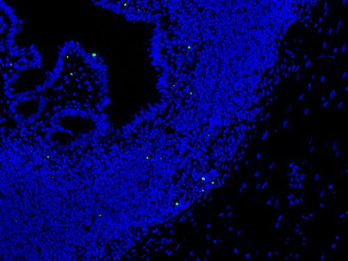 TUNEL（熒光）檢測(cè)