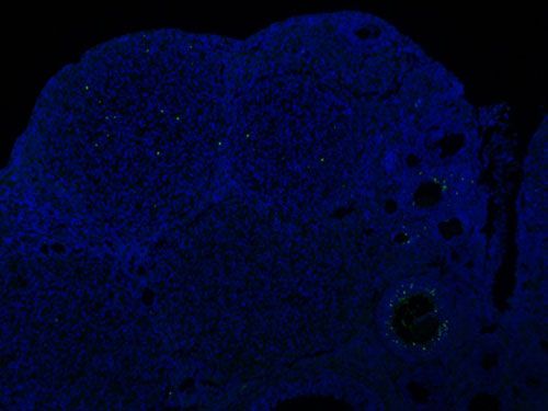 TUNEL（熒光）檢測(cè)