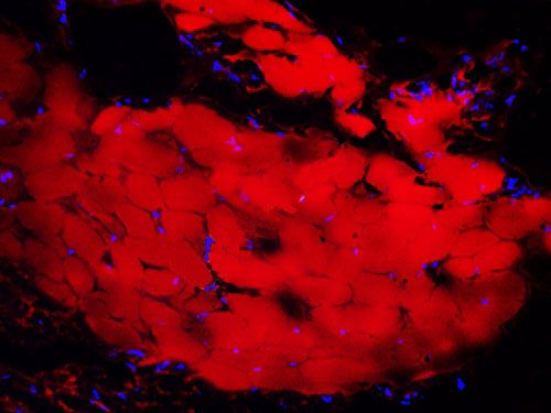 尼羅紅染色（動物標本）