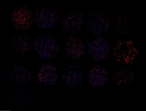 免疫熒光（單標(biāo)，組織芯片）