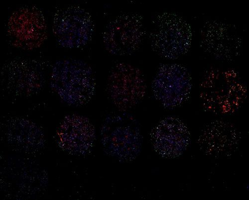 免疫熒光（雙標，細胞芯片）
