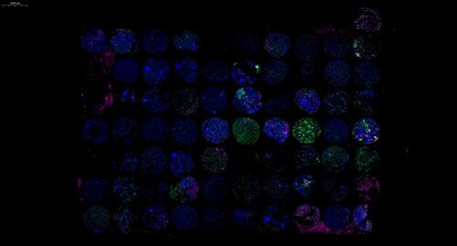 組織芯片免疫熒光三標