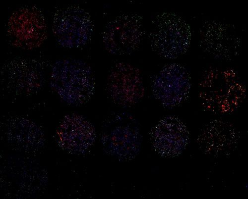 免疫熒光（雙標，組織芯片）