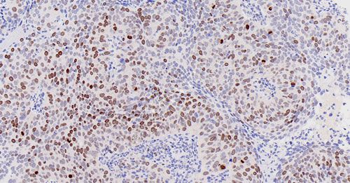 免疫組化（組織芯片）