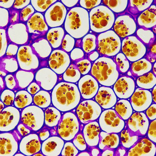 PAS-萘酚黃S染色