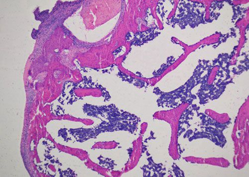 未脫鈣骨HE染色