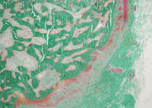 未脫鈣骨Goldner三色法染色