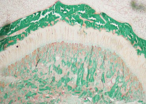 未脫鈣骨Goldner三色法染色