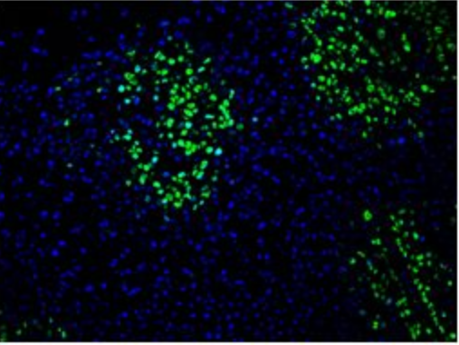 TUNEL染色檢測細胞增殖