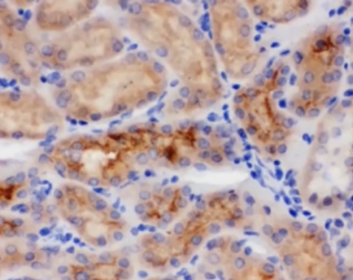 免疫組化IHC染色實驗結果解讀