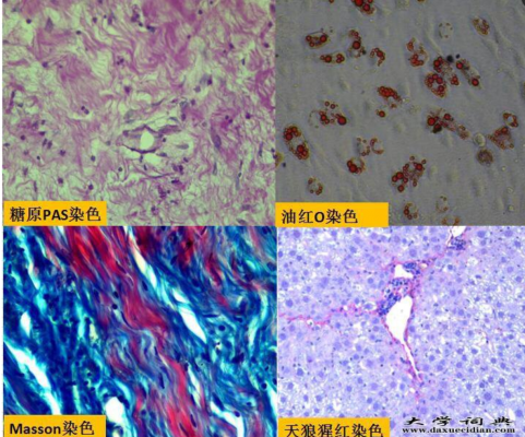 病理特殊染色合集，用途加結果判讀